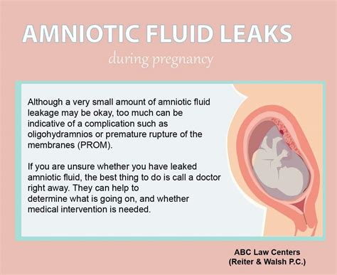 amniotic.fluid leaking|Amniotic Fluid: What is It and Signs of Leaking